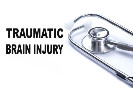 TBI After Car Accident - What Do I Need to Know?